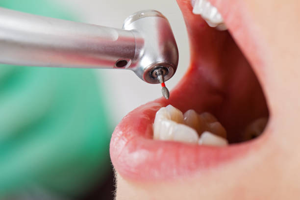 Best Emergency TMJ Treatment in Excelsior, MN
